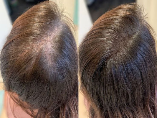 Hair Tonic - Флорална вода за растеж и сгъстяване